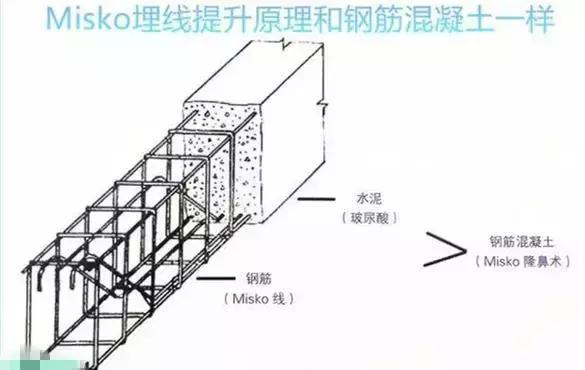 玻尿酸+埋线隆鼻 不开刀也能挺起鼻尖|名医专访