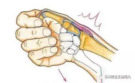 “打封闭”到底是好还是不好?哪些病可以打?