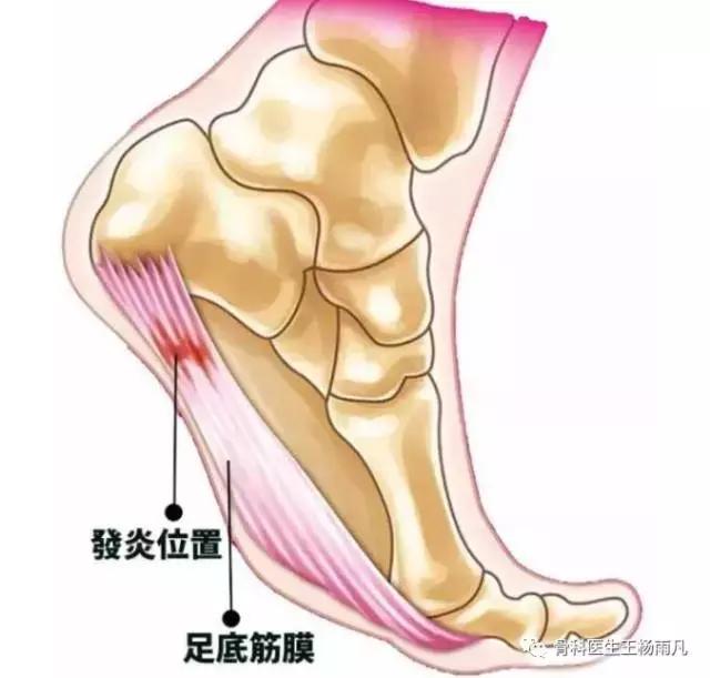 “打封闭”到底是好还是不好?哪些病可以打?