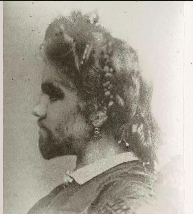 世界上最丑的女人,生前被当怪物,死后遗体被丈夫展览100多年...