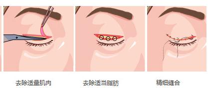 如何把小眼睛变大,这样方法你可能不知道