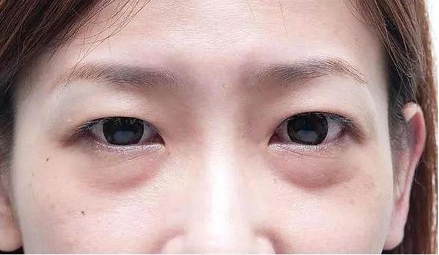 眼袋是女人的天敌,通过巧妙的化妆来遮盖眼袋的方法