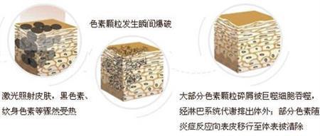 眼睛下面长斑的原因 你知道多少呢?