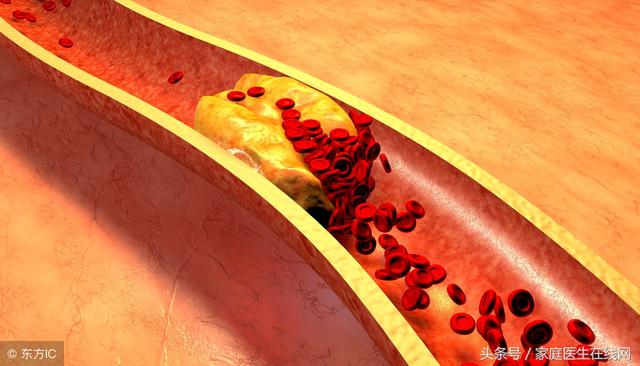 胆固醇是什么？不注意这3件事，血液中胆固醇会“爆表”