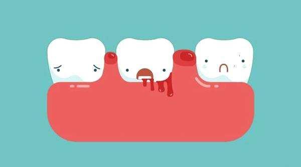 牙龈炎常见问题？让你学会怎么处理！