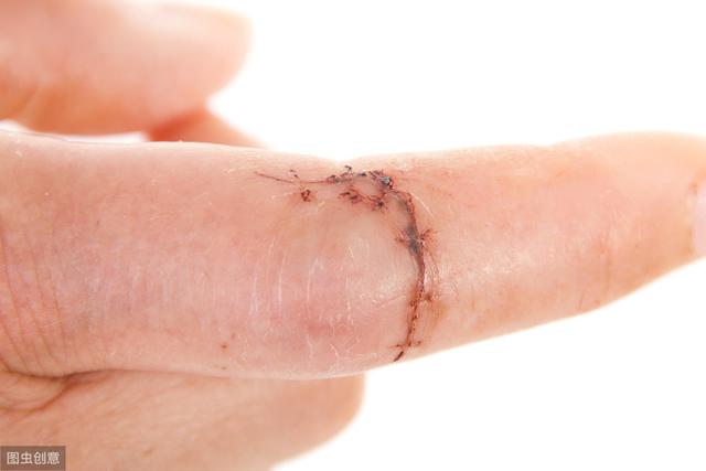 路医生说丨手术之后疤痕明显，有什么药物能有效消除或预防疤痕？